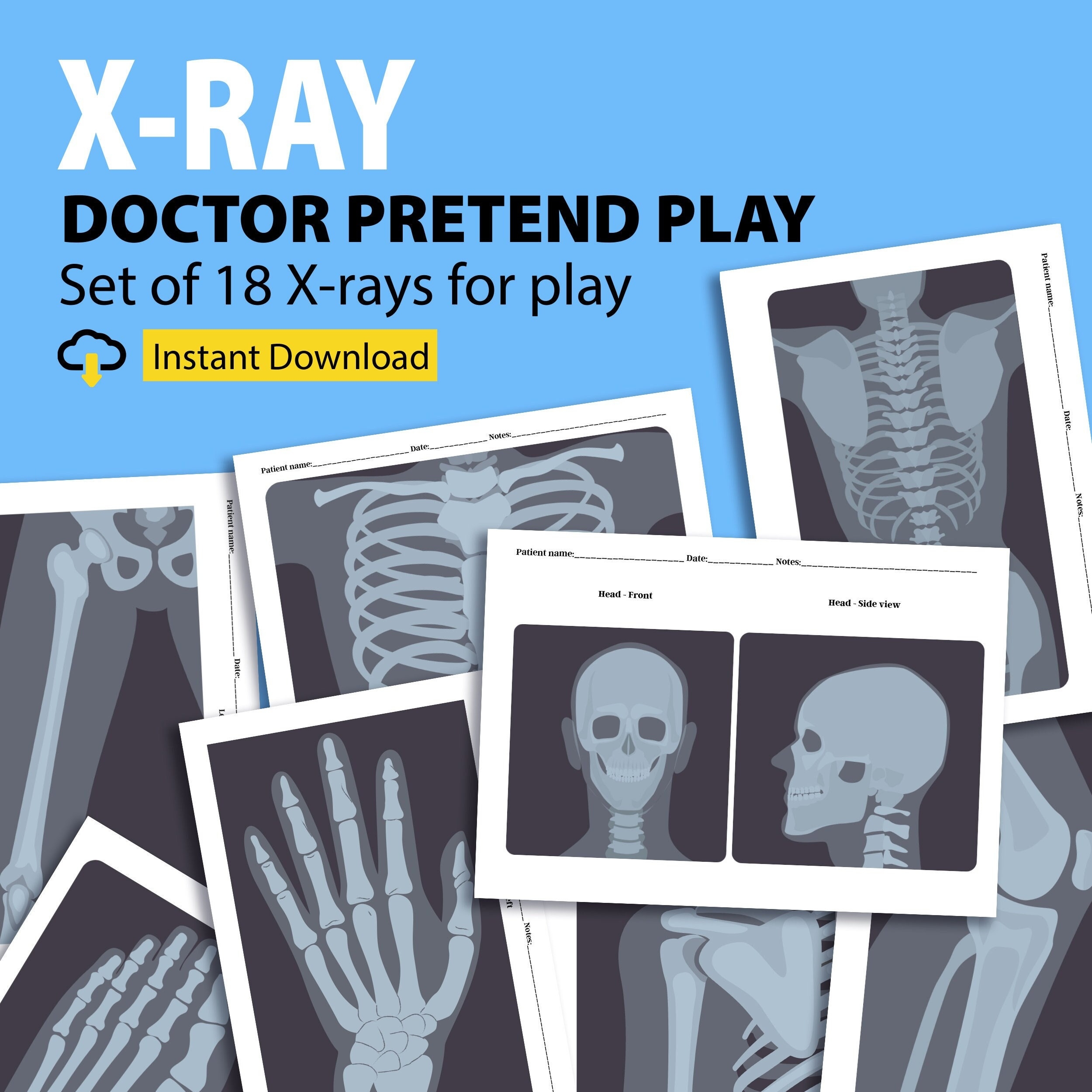 Printable X rays For Kids Pretend Play Doctors Pretend Play Worksheets Library